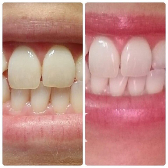 Whitening toothpaste - Picture 4 of 4